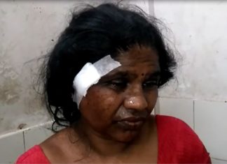 ମାଆ, ଝିଅଙ୍କୁ ଛୁରାମାଡ