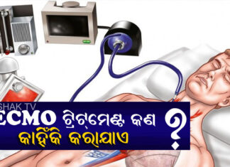 ଇକମୋ ଟ୍ରିଟମେଣ୍ଟ ପାଇଁ ଓଡିଶାରୁ ରୋଗୀ ବାହାର ରାଜ୍ୟକୁ ଯାଉଛନ୍ତି କଣ ପାଇଁ ?