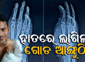 ହାତରେ ଲାଗିଲା ଗୋଡ ଆଙ୍ଗୁଠି