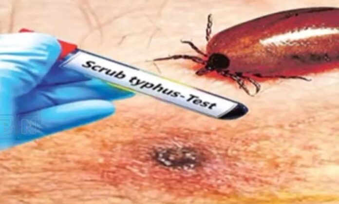 1988005-scrub-typhus (1)